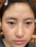 眼袋去除神器眼霜去大眼袋严重中老年男女士专用消除黑眼圈精华油 1瓶装【当晚消眼袋】 实拍图