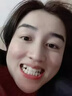 泊舒儿童牙齿矫正器成人深覆合门牙龅牙纠正隐形牙套地包天凸嘴矫正器 儿童款A类大号3个，适合10-14岁 实拍图