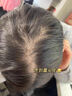 维特丝（vetes）育发液防脱发育发浓密增长液生发剂固发增长密男女头皮护理精华液 实拍图