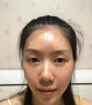 脸部凹陷填充液胶原蛋白太阳穴泪沟眼窝凹陷填充神器面部修复精华 买2送1【三天变圆脸】 实拍图