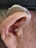 奥迪康oticon智能降噪隐形丹麦芯片老年人耳聋耳背式助听器Jet2BTE 双耳 实拍图