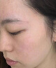 珂语苦参根祛痘膏草本植萃去痘痘和痘印痤疮炎痘青春专用痘坑面霜护肤 祛痘膏1瓶+洗脸巾 实拍图