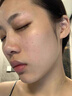 维特丝水杨酸祛痘精华液烟酰胺淡痘印去痘痘和痘印收毛孔修护保湿男女士 实拍图