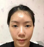 脸部凹陷填充液胶原蛋白太阳穴泪沟眼窝凹陷填充神器面部修复精华 买2送1【三天变圆脸】 实拍图
