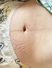 Newliann医用去妊娠纹修复霜产后去除肥胖纹淡化生长纹消除紧致肚皮疤痕膏 实拍图