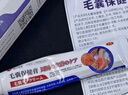 藤田制药湿疹药膏止痒皮肤瘙痒皮炎湿疹真菌感染汗疱疹肛门瘙痒1盒 实拍图