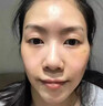 脸部凹陷填充液胶原蛋白太阳穴泪沟眼窝凹陷填充神器面部修复精华 买2送1【三天变圆脸】 实拍图
