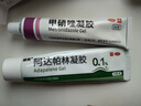 丽芙甲硝唑凝胶30g+阿达帕林凝胶35g甲硝锉凝胶祛痘印修复淡化痘印痘坑修复药膏 实拍图