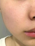 医用精华液械字号收缩毛孔粗大修复细致去黑头粉刺闭口男士女士祛痘印黑色素沉淀控油淡化痘印痘坑透明质酸钠 实拍图