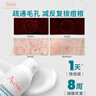 雅漾（Avene）【樊振东同款】控油抗痘精华露30ml C位精华敏肌细致毛孔效期27.3 实拍图