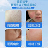ADPWY儿童脸上小颗粒小疙瘩鸡皮肤去除神器毛周角化专用可搭药膏青少年 实拍图
