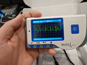 优睿（MEDRUI）心脏心电图检测仪医用24小时动态心电图记录仪家用心率心跳监护仪 实拍图