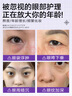 奈皙日本眼膜眼袋提拉紧致抗皱淡化细纹黑眼圈去除神器男士严重专用女 实拍图
