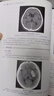 影像读片从入门到精通系列--CT读片指南（第三版） 实拍图