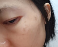 花姬赏【品牌直授】烟酰胺美白祛斑次抛精华液补水保湿提亮肤色 5盒巩固装/美白祛斑次抛精华液 实拍图