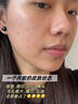 透真祛痘次抛精华液淡化痘印收缩毛孔舒缓泛红痤疮无水杨酸青春期学生 实拍图