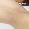 泊紫汀兰（Pozitilan）男士脱毛膏腋下私密处温和脱去毛全身四肢非永久根去不再生长200g 实拍图