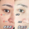 透真377美白祛斑保湿爽肤水补水抗皱紧致湿敷提亮去黄改善暗沉肤色 实拍图