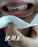 牙结石清理神器牙垢清除专用膏抑菌除i去i口臭口气重嘴巴臭溶解液 1喷+1刷【黄金组合】 去i除i口臭口气重嘴巴臭 实拍图