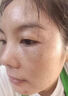 藤川岗田祛斑点斑专用一夜消去斑霜黑色素脸部手背医用正品老年斑晒斑进口 一盒装【日本进口一夜消】 美白淡化祛斑去黑色素黄褐雀斑晒斑男女士用的特效非药 实拍图