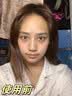 熊果苷乳膏去黑眼圈脸部去斑去除黑色素医熬夜眼霜复方男女士 1盒烟酰胺+熊果苷【组合装】 实拍图