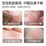 朋禾专利特护膏新生儿童舒缓肌肤不适婴儿红PP呵护肌肤宝宝霜特护霜 【2支更划算】婴儿特护膏25g*2支 实拍图
