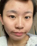 维特丝愈创木祛痘精华淡化痘印去痘痘收毛孔男女士护肤品青春期学生专用 实拍图
