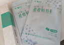 云南白药泰邦痘痘贴型创口贴 轻薄透气皮外伤擦伤贴家用创口贴 45粒*2袋 实拍图