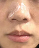 酒糟鼻专用红肿长痘草莓红鼻子血丝痤疮膏药贴修复红鼻子槽玫瑰痤疮抑菌酒槽鼻凝胶 一盒装 治(发货特效快)疗鼻子红血丝修复去除 实拍图