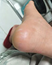 dyey凡士林马油手足皲裂膏护手霜冬季防干裂冻疮保湿滋润干裂膏50g 实拍图