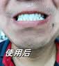 牙结石清理神器牙垢清除专用膏抑菌除i去i口臭口气重嘴巴臭溶解液 1喷+1刷【黄金组合】 去i除i口臭口气重嘴巴臭 实拍图