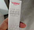维德（WELLDAY）医用硅酮疤痕凝胶儿童成人防增生手术缝针助修复除疤祛疤膏20g/支 实拍图