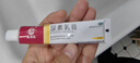 马应龙尿素乳膏10%20g/盒 尿素软膏尿素霜医用尿素乳膏手脚干裂干燥手足皲裂脚后跟干裂膏角化型脚气 实拍图
