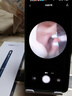 bebird 可视挖耳勺蜂鸟镊子洁耳仪掏耳朵神器采耳清洁工具 Note5 星空蓝 实拍图