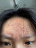维特丝愈创木祛痘精华淡化痘印去痘痘收毛孔男女士护肤品青春期学生专用 实拍图
