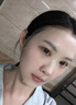 白云山壬二酸祛痘面膜10片淡化痘印控油祛痘毛孔收缩补水保湿男女士 实拍图