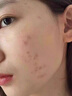 五羊（FIVERAMS）祛痘膏祛痘淡化痘印修复青春痘学生青少年专用中药祛痘膏30g 实拍图