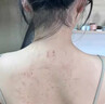 毛囊炎沐浴露后背部长痘痘马拉色菌痤疮湿疹皮炎止痒抑菌神器洗液 单盒体验装【无惧皮肤问题】 实拍图
