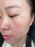 华美科氨甲环酸精华液医黄褐斑用祛斑美白提亮去黄改善暗沉肤色湿敷1支 实拍图
