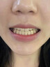 韩方五谷炫白牙齿亮白牙贴去黄洁白美牙一次性贴片温和不酸急救大白牙洁牙 实拍图