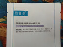 可复美医用透明质酸钠修复贴 激光子术后 微整浅表性创面部皮肤护理敷料 医用修复贴7片【2片*3盒+1片】 实拍图