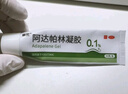 丽芙阿达帕林凝胶35g/盒第三代维a酸乳膏医用祛痘印修复淡化痘印痘坑修复祛痘药膏去黑头收缩毛孔粗大修复 实拍图