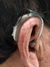 奥迪康oticon智能降噪丹麦芯片老年人耳聋耳背式助听器 Jet2 BTE PP双耳 实拍图