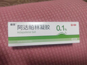丽芙阿达帕林凝胶35g/盒第三代维a酸乳膏医用祛痘印修复淡化痘印痘坑修复祛痘药膏去黑头收缩毛孔粗大修复 实拍图