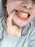 韩方五谷炫白牙齿亮白牙贴去黄洁白美牙一次性贴片温和不酸急救大白牙洁牙 实拍图