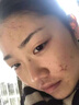 维特丝愈创木祛痘精华淡化痘印去痘痘收毛孔男女士护肤品青春期学生专用 实拍图