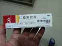 马应龙 红霉素软膏1%*10g/盒 抗菌消炎脓疱疮化脓皮肤病溃疡面感染痤疮烧烫伤擦伤感染 实拍图