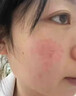 E'YEARN去增厚角质层薄高原红 红血丝舒缓过敏感肌肤面霜 一盒装 实拍图
