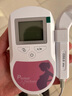 CONTEC康泰多普勒胎心仪胎心监测仪家用胎心监护仪 孕妇家用Sonoline A 实拍图