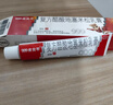 999三九皮炎平复方醋酸地塞米松乳膏20g/支 止痒药膏 神经性皮炎 接触性皮炎 脂溢性皮炎 湿疹 干性湿疹 实拍图